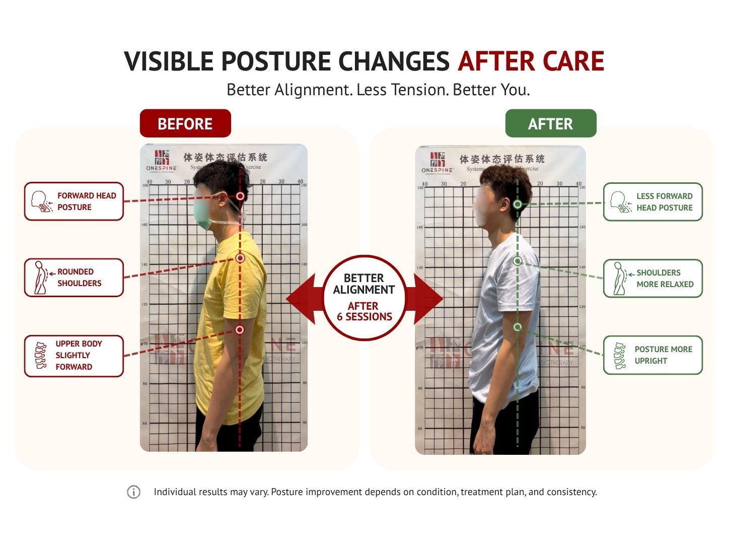 Actual One Spine patient before and after posture change showing rehabilitation progress